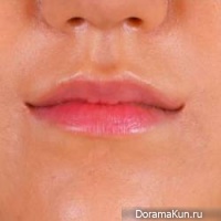 Модный бум в Южной Корее : женщины делают себе джокеропластику